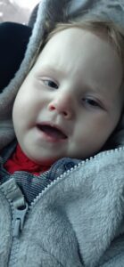 Zosia zaraz po zakropleniu atropiny podczas badania refrakcji cykloplegicznej